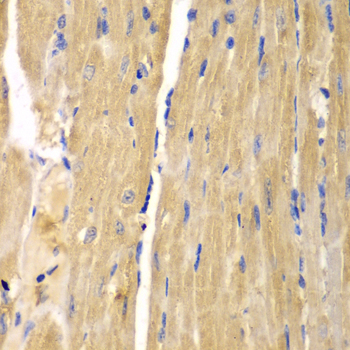 Anti-SLC25A13 Antibody (CAB5849)