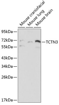 Anti-TCTN3 Antibody (CAB0684)