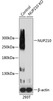 Anti-NUP210 Antibody [KO Validated] (CAB19895)