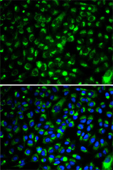 Anti-CYP2E1 Antibody (CAB2160)