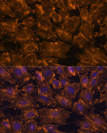 Anti-SCGB3A2 Antibody (CAB13137)