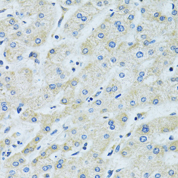 Anti-SLC5A6 Antibody (CAB14814)
