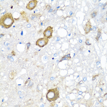 Anti-MGP Antibody (CAB5439)