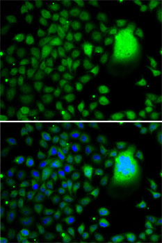 Anti-TAF5 Antibody (CAB7221)