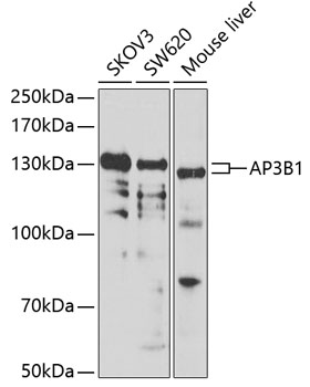 Anti-AP3B1 Antibody (CAB7019)