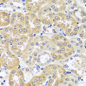 Anti-CCDC124 Antibody (CAB14436)