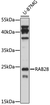 Anti-RAB28 Antibody (CAB17368)