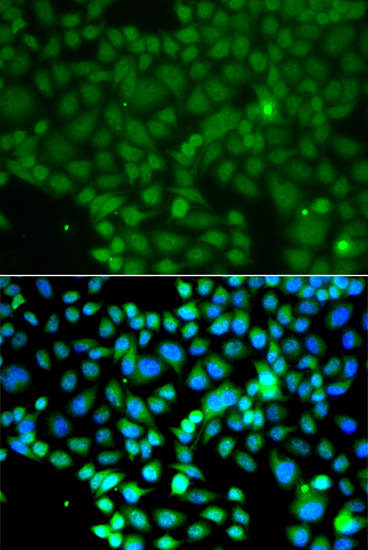 Anti-FRK Antibody (CAB7556)