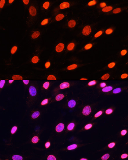 Anti-Pan DiMethyl-lysine Antibody (CAB5870)