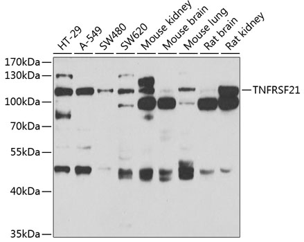 Anti-TNFRSF21 Antibody (CAB7365)