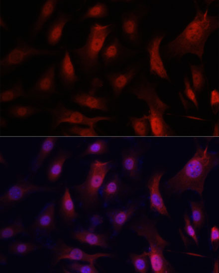 Anti-YAP1 Antibody [KO Validated] (CAB11264)