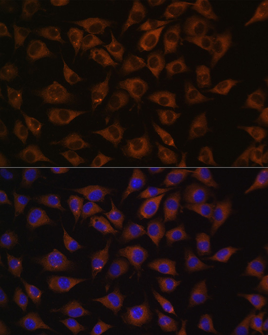 Anti-PHB Antibody (CAB0056)