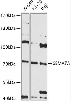 Anti-SEMA7A Antibody (CAB12039)