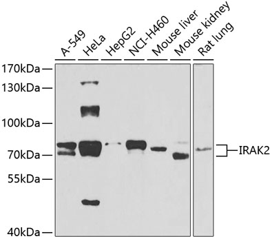 Anti-IRAK2 Antibody (CAB6635)