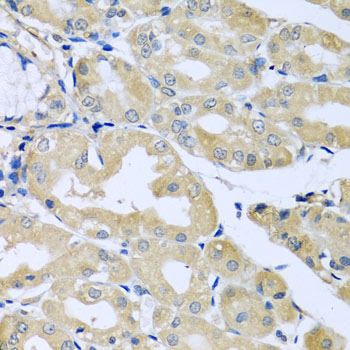 Anti-HS1BP3 Polyclonal Antibody (CAB8250)