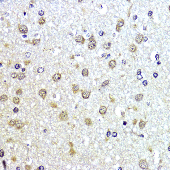 Anti-SUMO1 Antibody (CAB2130)