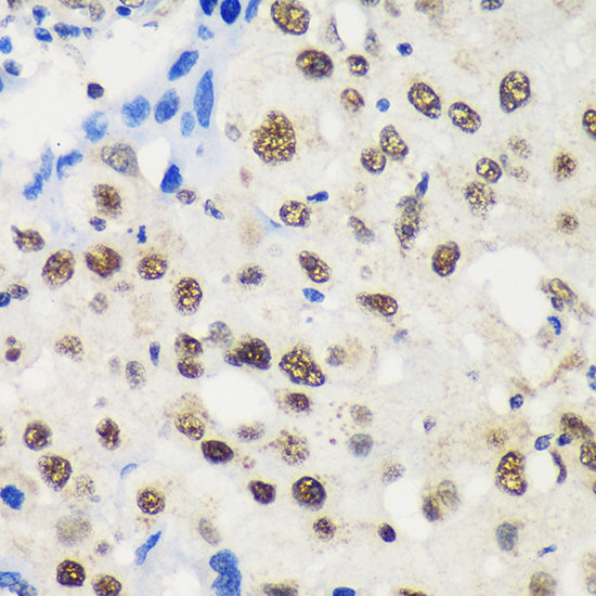 Anti-LARP1B Antibody (CAB13222)