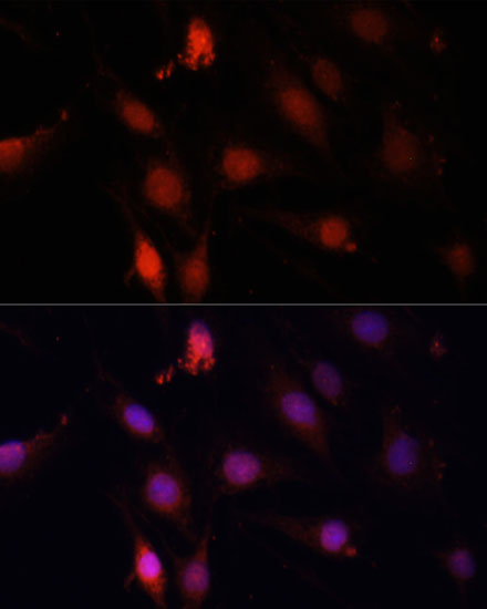 Anti-GBX2 Antibody (CAB14733)