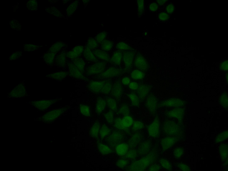 Anti-CTSE Antibody (CAB2678)