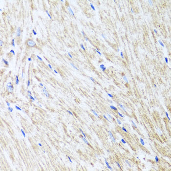 Anti-L2HGDH Polyclonal Antibody (CAB7996)