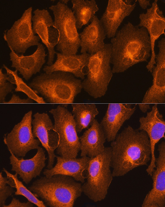 Anti-HLA-C Antibody (CAB1013)