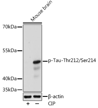 Anti-Phospho-Tau-Thr212/Ser214 Antibody (CABP1126)