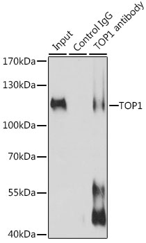 Anti-TOP1 Antibody (CAB12524)