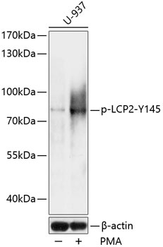 Anti-Phospho-LCP2-Y145 pAb (CABP0816)