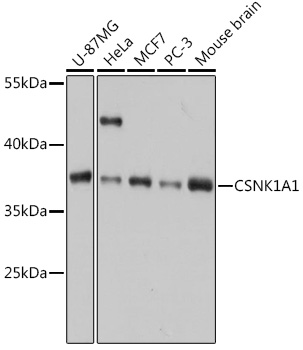 Anti-CSNK1A1 Antibody (CAB16225)