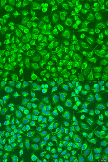 Anti-ENTPD5 Polyclonal Antibody (CAB8108)