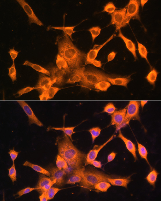 Anti-FoxO3a Antibody (CAB0102)