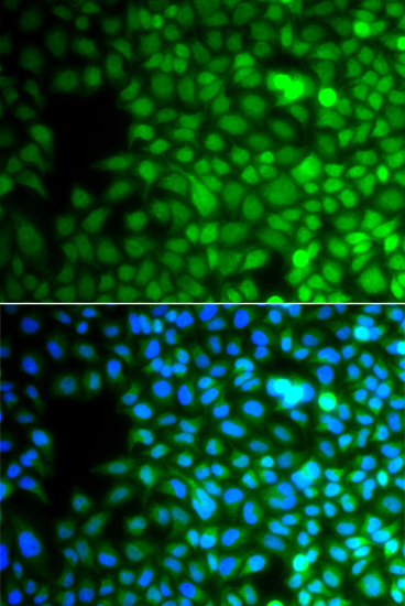 Anti-ZNF195 Antibody (CAB7347)