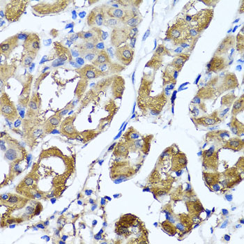 Anti-HYAL1 Antibody (CAB6623)