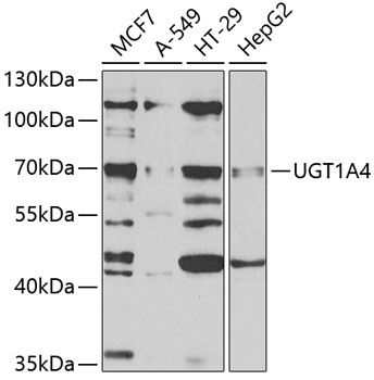 Anti-UGT1A4 Antibody (CAB5549)