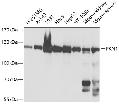 Anti-PKN1 Antibody (CAB0553)