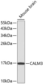 Anti-CALM3 Antibody (CAB1161)