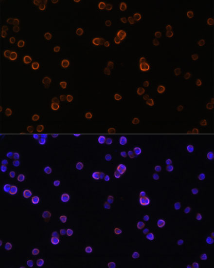 Anti-PLCG2 Antibody (CAB2182)