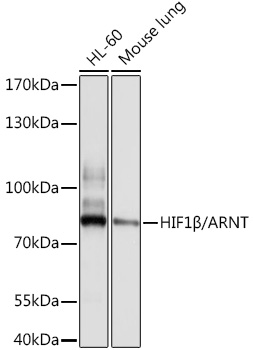 Anti-HIF1Beta/ARNT Antibody (CAB0972)