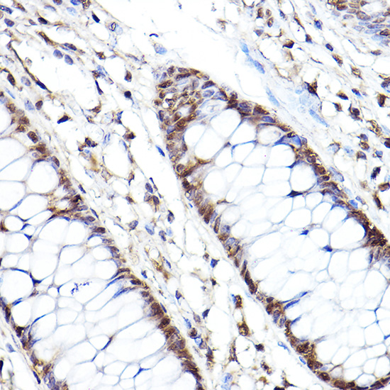 Anti-PSMB2 Antibody (CAB13630)