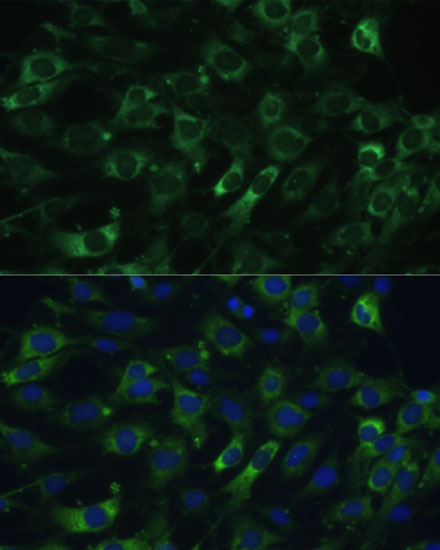 Anti-EEF1G Antibody (CAB7891)