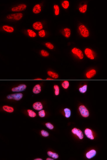 Anti-PRPF3 Antibody (CAB5482)