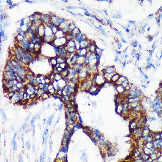 Anti-CHCHD2 Antibody [KO Validated] (CAB16645)