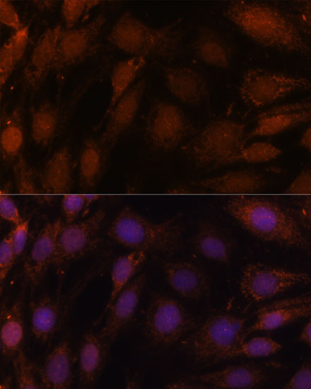 Anti-GCAT Antibody (CAB15802)