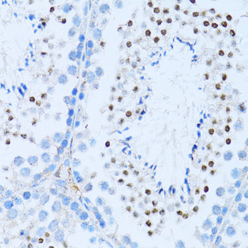 NF-kB2 Rabbit Polyclonal Antibody (CAB3108)