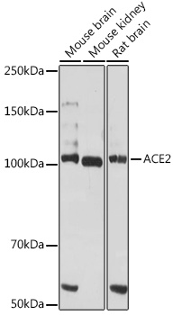 Anti-ACE2 Antibody (CAB12737)