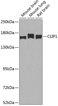 Anti-CLIP1 Antibody (CAB7722)