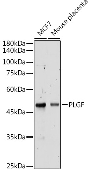 Anti-PLGF Antibody (CAB16257)