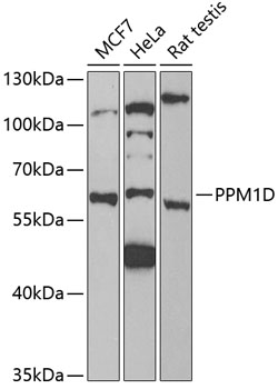 Anti-PPM1D Antibody (CAB6204)