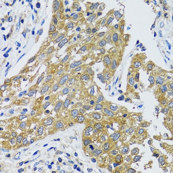 Anti-GOT1 Antibody (CAB5822)