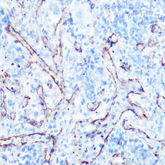 Anti-Caveolin-1 Antibody (CAB1555)